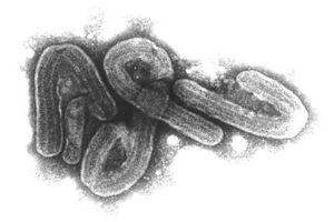 Eine elektronenmikroskopische Aufnahme des Marburg-Virus. - Foto: Bernhard-Nocht-Institut/dpa