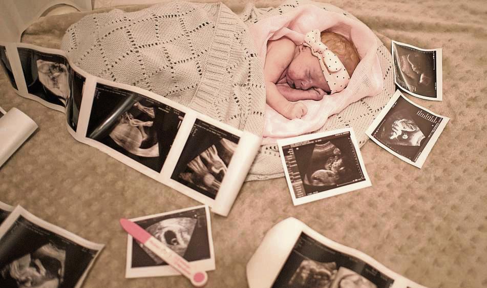 Nicht immer halten die Eltern nach einem positiven Schwangerschaftstest ein gesundes Kind in den Armen: Charlotte hatte Trisomie 18 und starb an ihrem 18. Lebenstag. Foto: Karin Schlüter