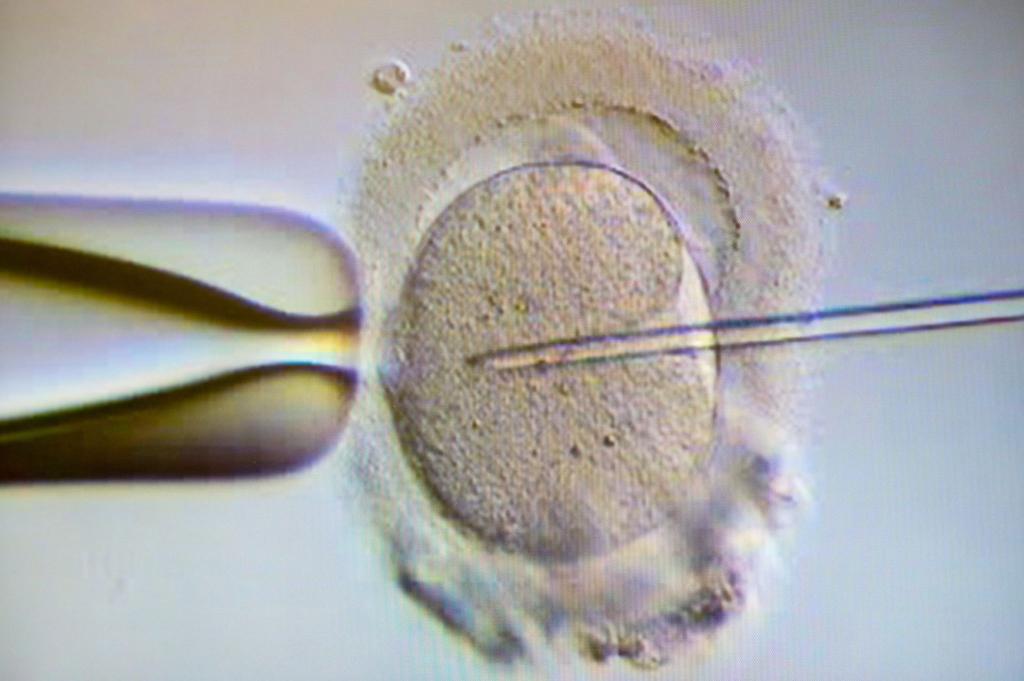 Ein Spermium wird eine Eizelle injiziert. Wird die Eizellenspende bald legal? (Archivbild) - Foto: Klaus-Dietmar Gabbert/dpa-Zentralbild/dpa
