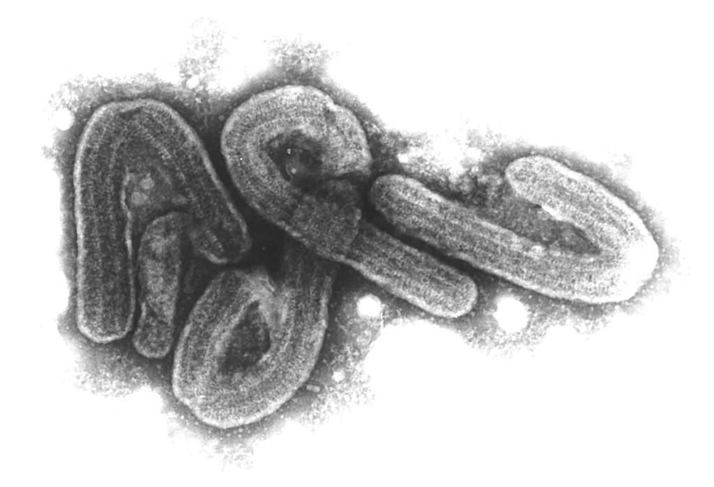 Eine elektronenmikroskopische Aufnahme des Marburg-Virus. - Foto: Bernhard-Nocht-Institut/dpa